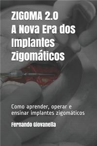 ZIGOMA 2.0 - A Nova Era dos Implantes Zigomáticos