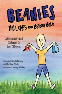 Beanies, Ball Caps, and Being Bald