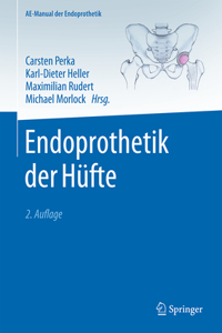 Endoprothetik Der Hüfte