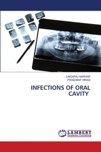 Infections of Oral Cavity