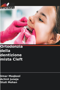 Ortodonzia della dentizione mista Cleft