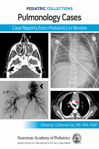 Pulmonology Cases