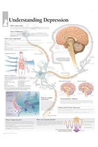 Understanding Depression Laminated Poster