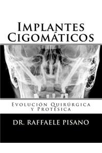 Implantes Cigomáticos