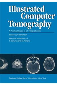 Illustrated Computer Tomography