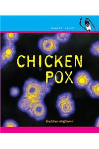 Chicken Pox