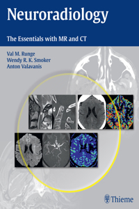 Neuroradiology