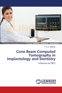 Cone Beam Computed Tomography in Implantology and Dentistry