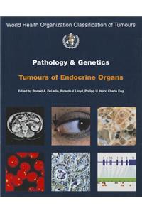 Pathology and genetics of tumours of the endocrine organs