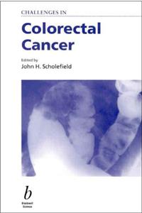 Challenges in Colorectal Cancer