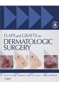 Flaps and Grafts in Dermatologic Surgery