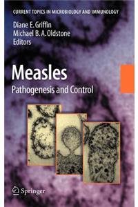 Measles