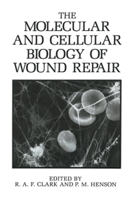 Molecular and Cellular Biology of Wound Repair