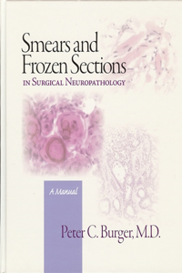 Smears and Frozen Sections in Surgical Neuropathology