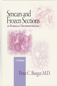 Smears and Frozen Sections in Surgical Neuropathology: A Manual