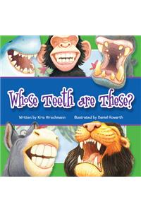 Whose Teeth Are These?