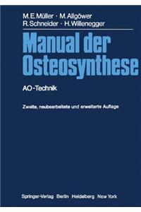 Manual Der Osteosynthese: Ao-Technik