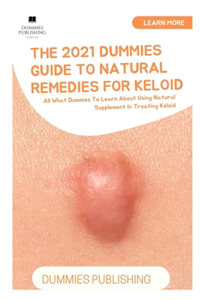 The 2021 Dummies Guide to Natural Remedies for Keloid