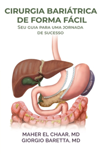 Cirurgia Bariátrica De Forma Fácil