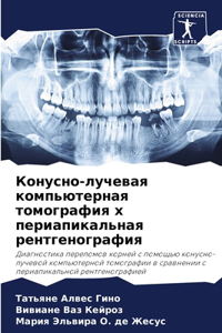 Конусно-лучевая компьютерная томография