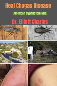 Heal Chagas Disease (American trypanosomiasis)