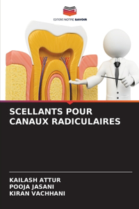 Scellants Pour Canaux Radiculaires