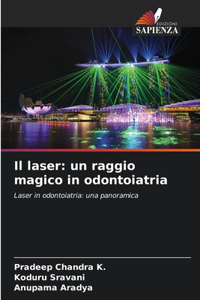 Il laser