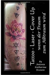 Tattoo - Laser - Cover Up: Wenn Der Traum Zum Albtraum Wird