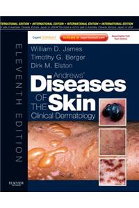 Andrews' Diseases Of The Skin, International Edition With Expert Consult – Online And Print