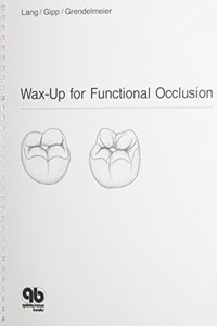 Wax-Up For Functional Occlusion