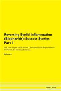 Reversing Eyelid Inflammation (Blepharit