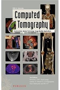 Computed Tomography