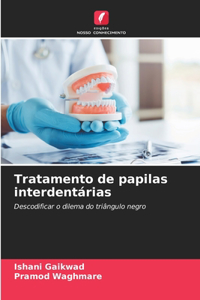 Tratamento de papilas interdentárias