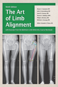 Art of Limb Alignment with Excerpts from the Baltimore Limb Deformity Course Workbook