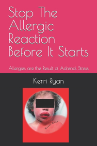 Stop The Allergic Reaction Before It Starts