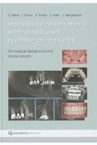 Immediate Restorations with a Reduced Number of Implants