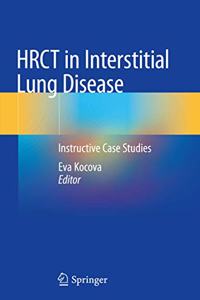 Hrct in Interstitial Lung Disease