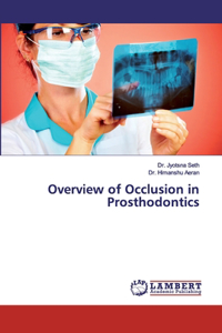 Overview of Occlusion in Prosthodontics