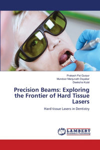 Precision Beams