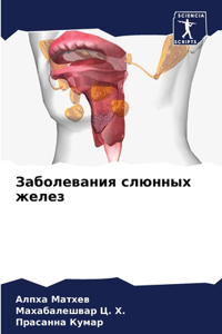 Заболевания слюнных желез