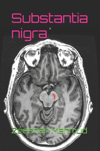 Substantia nigra