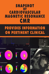 Snapshot Of Cardiovascular Magnetic Resonance CMR