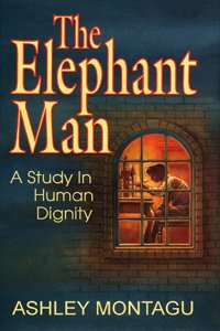 The Elephant Man