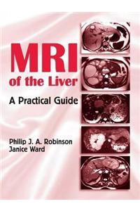 MRI of the Liver