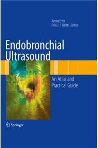 Endobronchial Ultrasound