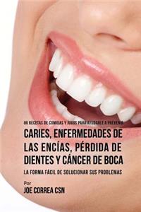 86 Recetas de Comidas y Jugos Para Ayudarle A Prevenir Caries, Enfermedades de Las Encías, Pérdida de Dientes y Cáncer de Boca