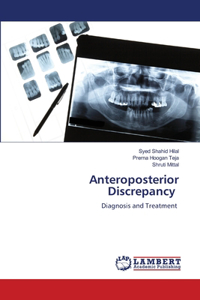 Anteroposterior Discrepancy