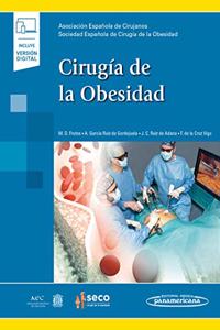 Cirugia de la Obesidad