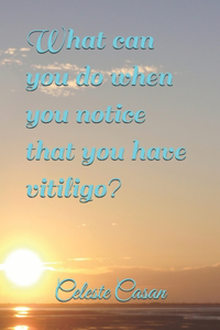 What can you do when you notice that you have vitiligo?