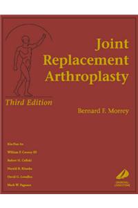 Joint Replacement Arthroplasty